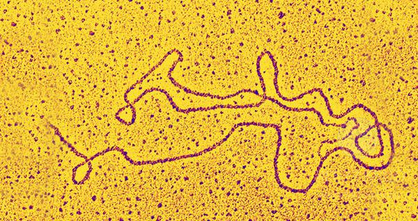 Теломера — концевой участок хромосомной ДНК (электронная микрофтография Dr. Gopal Murti)
