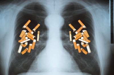 Около 30% смертей от рака оказались связаны с курением